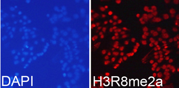 Asymmetric DiMethyl-Histone H3-R8 antibody