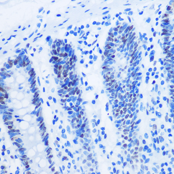 Asymmetric DiMethyl-Histone H3-R8 antibody