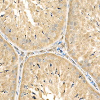 RelB antibody