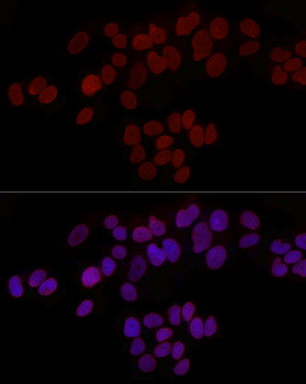 TMPO antibody