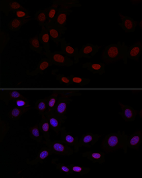 TMPO antibody