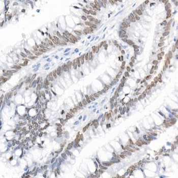 TMPO antibody