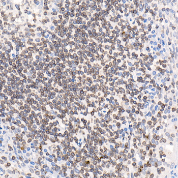 TMPO antibody