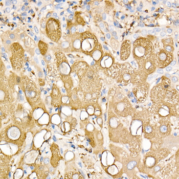 Ferritin antibody