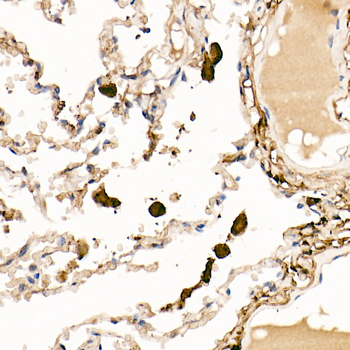 Ferritin antibody