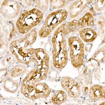 Ferritin antibody