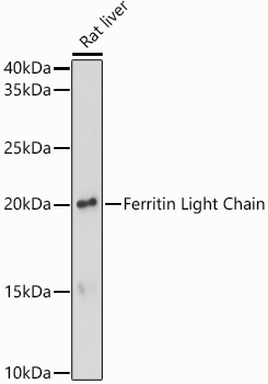 Ferritin antibody