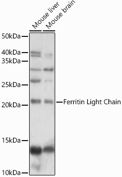 Ferritin antibody