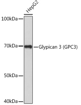 GPC3 antibody