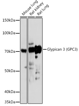 GPC3 antibody