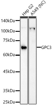 GPC3 antibody