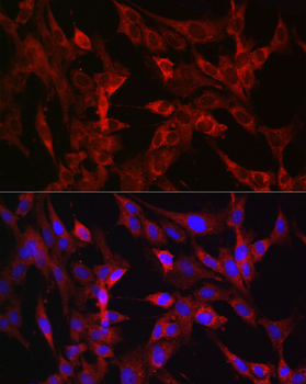 TMPRSS2 antibody