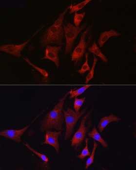 TMPRSS2 antibody