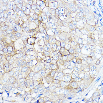 TMPRSS2 antibody