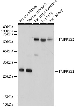 TMPRSS2 antibody