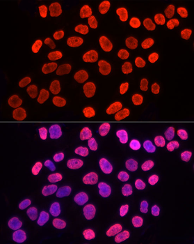 TriMethyl-Histone H3-K9 antibody