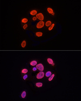 TriMethyl-Histone H3-K9 antibody