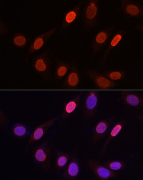 TriMethyl-Histone H3-K9 antibody