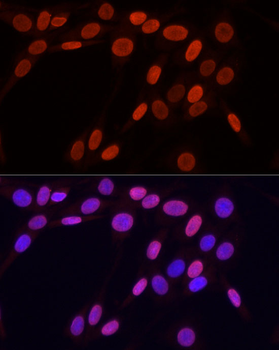 TriMethyl-Histone H3-K9 antibody