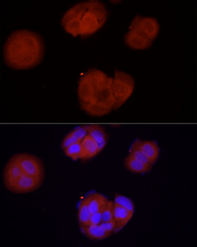 PRKACB antibody