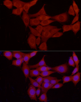 PRKACB antibody