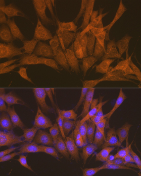 PRKACB antibody