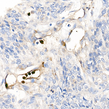 S100A12 antibody