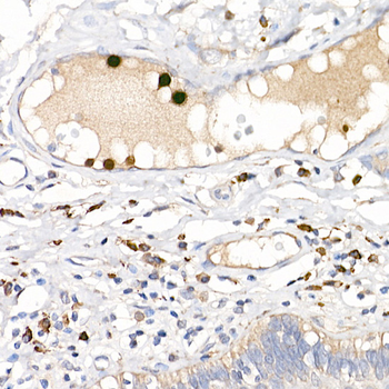 S100A12 antibody