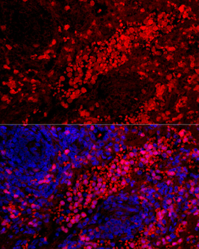 S100A12 antibody