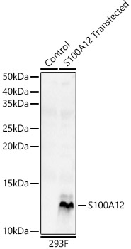 S100A12 antibody