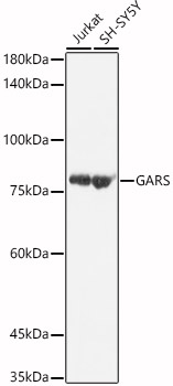 GARS antibody