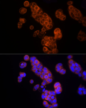 TK1 antibody