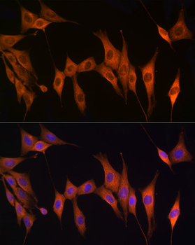 TK1 antibody