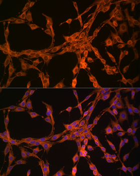 TK1 antibody