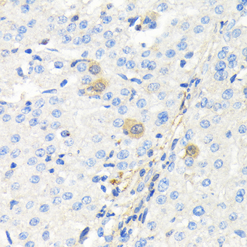 TK1 antibody