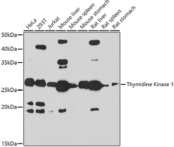 TK1 antibody