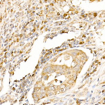 LC3 antibody