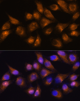 CD13 antibody