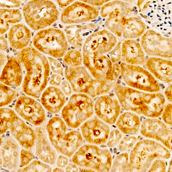 RPS10 Rabbit Antibody