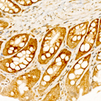 RPS10 Rabbit Antibody