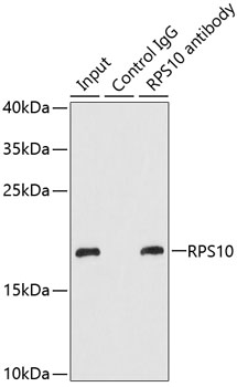 RPS10 Rabbit Antibody