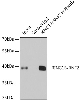 RING1B/RNF2 Rabbit Antibody