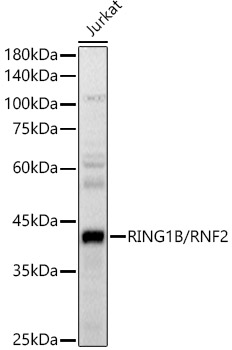 RING1B/RNF2 Rabbit Antibody