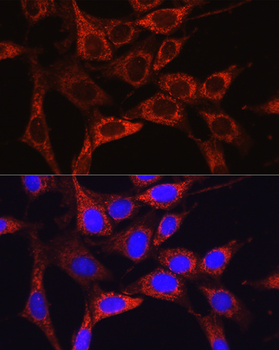 Glutamine Synthetase (GLUL) Rabbit Antibody