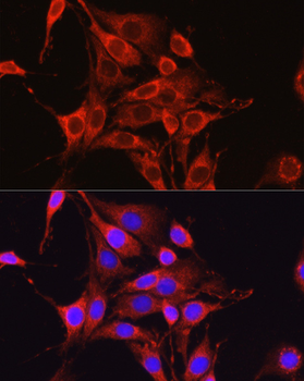 Glutamine Synthetase (GLUL) Rabbit Antibody