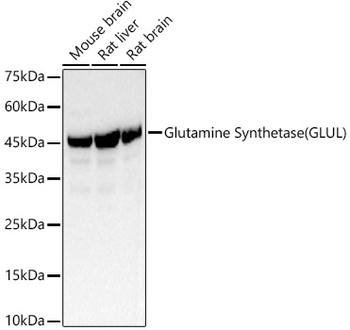 Glutamine Synthetase (GLUL) Rabbit Antibody