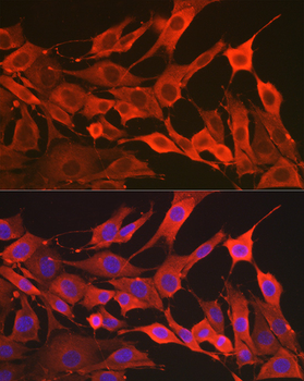 SOD2 Rabbit Antibody