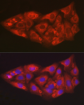 SOD2 Rabbit Antibody