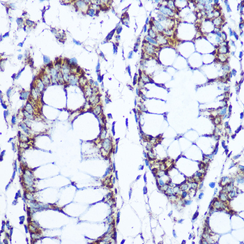 SOD2 Rabbit Antibody