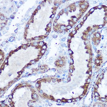 SOD2 Rabbit Antibody